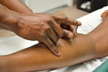 acupuncture, asian medicine, needles, brown medicine, acupuncture, acupuncture, acupuncture, acupuncture, acupuncture