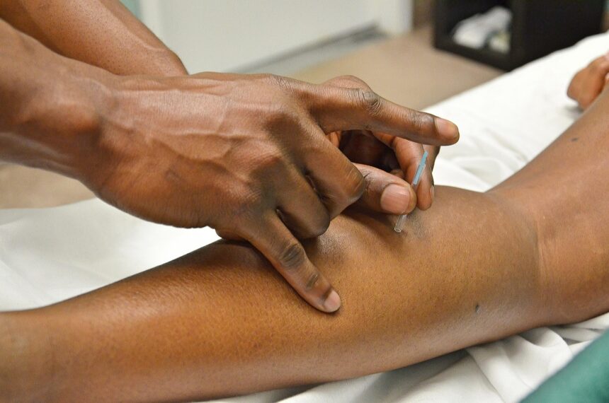 acupuncture, asian medicine, needles, brown medicine, acupuncture, acupuncture, acupuncture, acupuncture, acupuncture