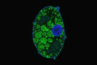 An illustrational microscopic image of a single yeast cell, oval-shaped and glowing with fluorescent colors. The cell is outlined in blue, while its interior is densely filled with a large amount of green, blob-like protein aggregates. A large blue nucleus is visible, pushed to one side by the overwhelming green protein clumps. A small scale bar in the bottom right corner indicates 5 micrometers.