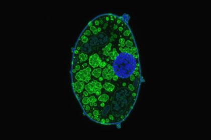 An illustrational microscopic image of a single yeast cell, oval-shaped and glowing with fluorescent colors. The cell is outlined in blue, while its interior is densely filled with a large amount of green, blob-like protein aggregates. A large blue nucleus is visible, pushed to one side by the overwhelming green protein clumps. A small scale bar in the bottom right corner indicates 5 micrometers.