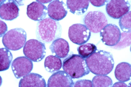 Microscopic image of Epstein–Barr virus (EBV) particles