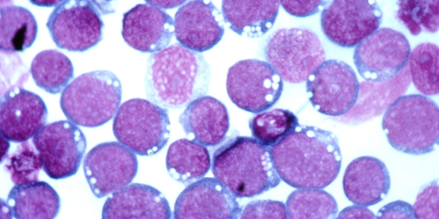 Microscopic image of Epstein–Barr virus (EBV) particles